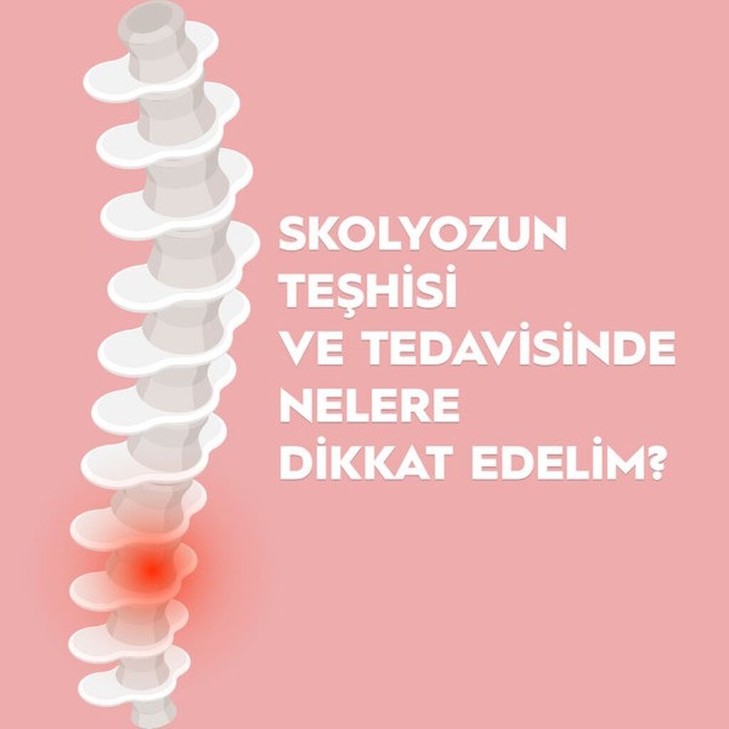 Skolyoz