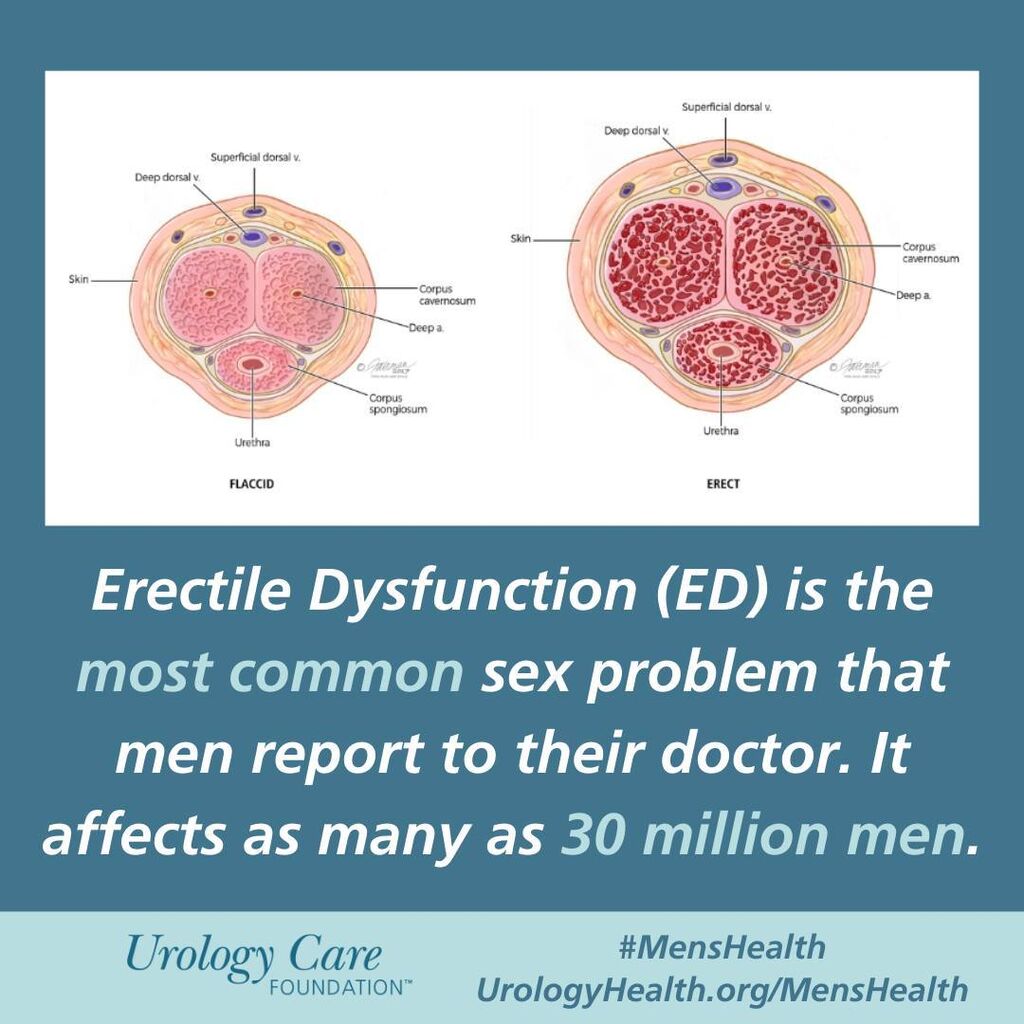 #ErectileDysfunction