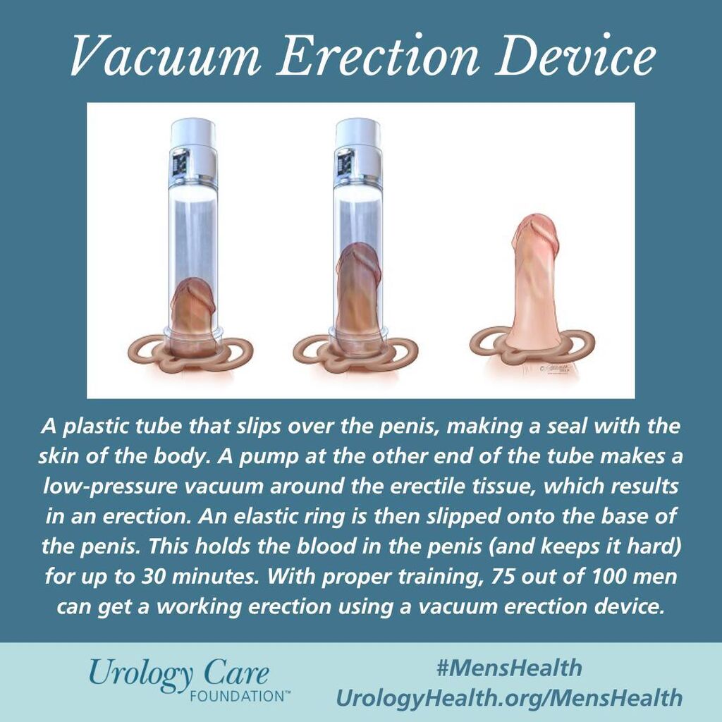 Vacuum Erection Device