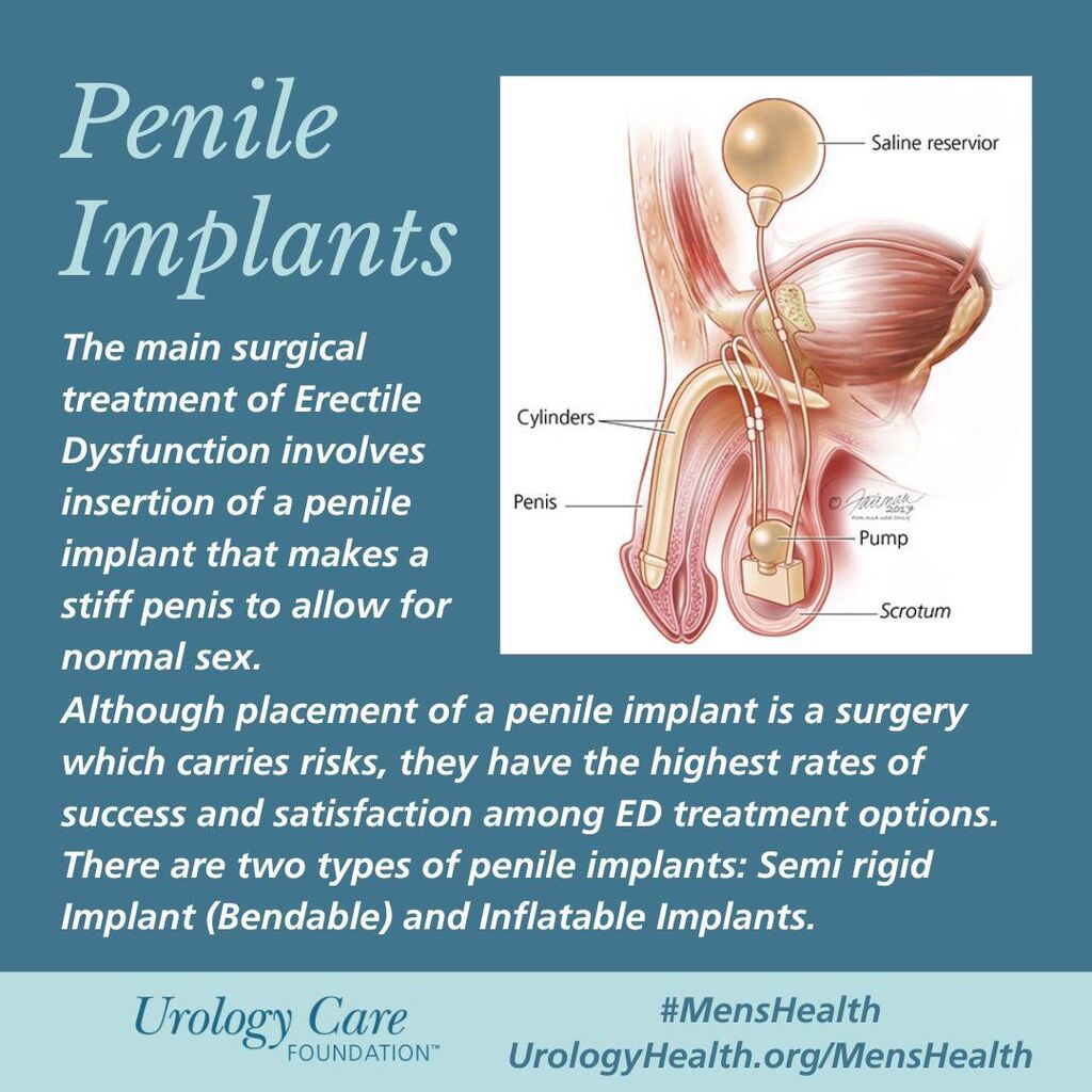 Penile Implants