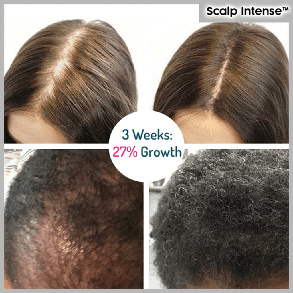 Roll-On Hair Growth Serum