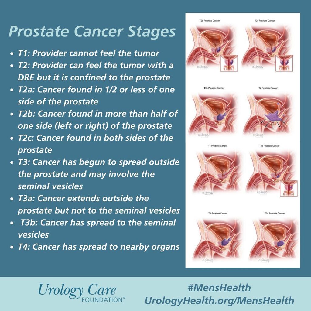 Tumor, Nodes and Metastasis (TNM) staging system