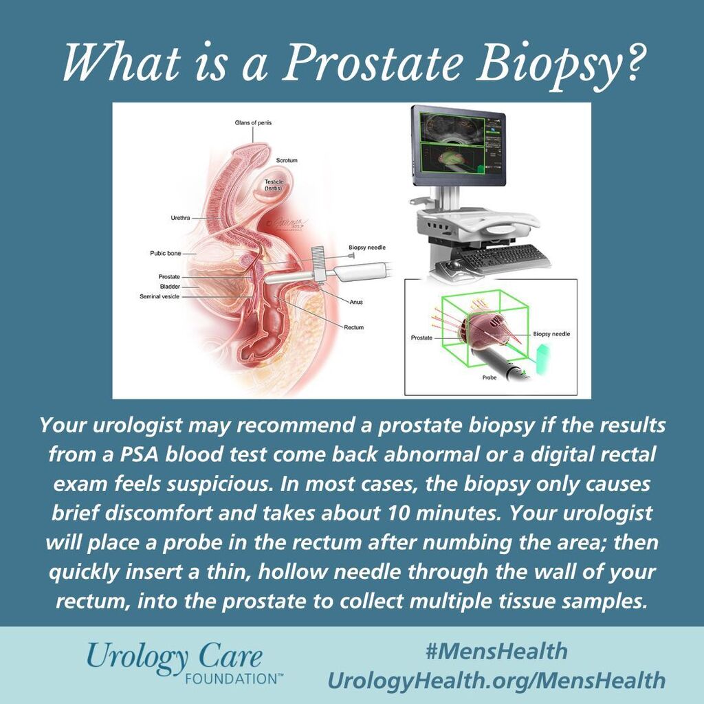 Prostate Biopsy