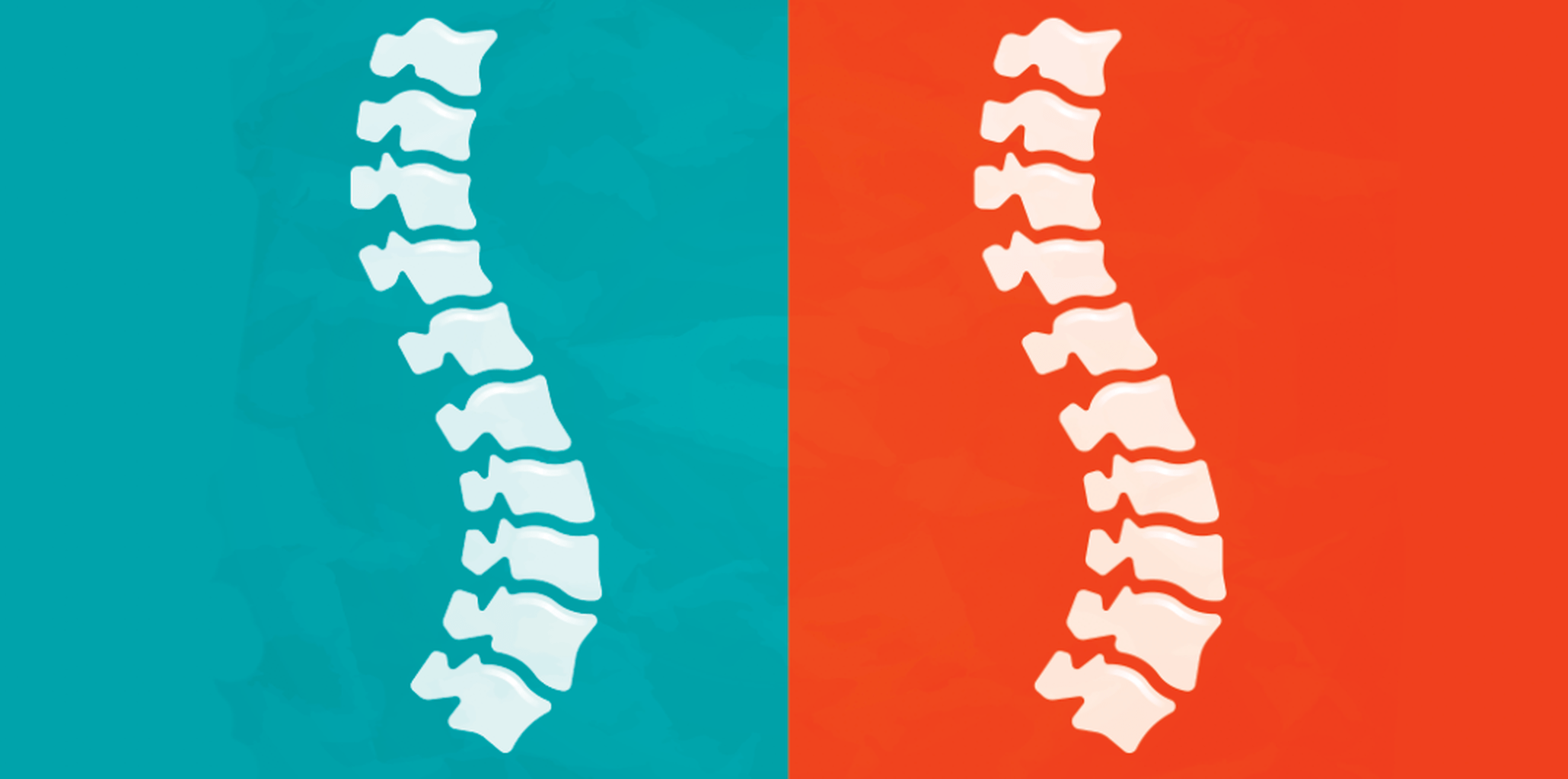 I Have Scoliosis And Here&rsquo;s What I Want You To Know