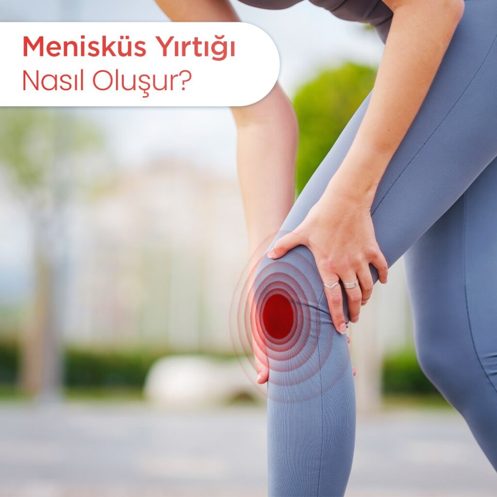 Menisk&uuml;s