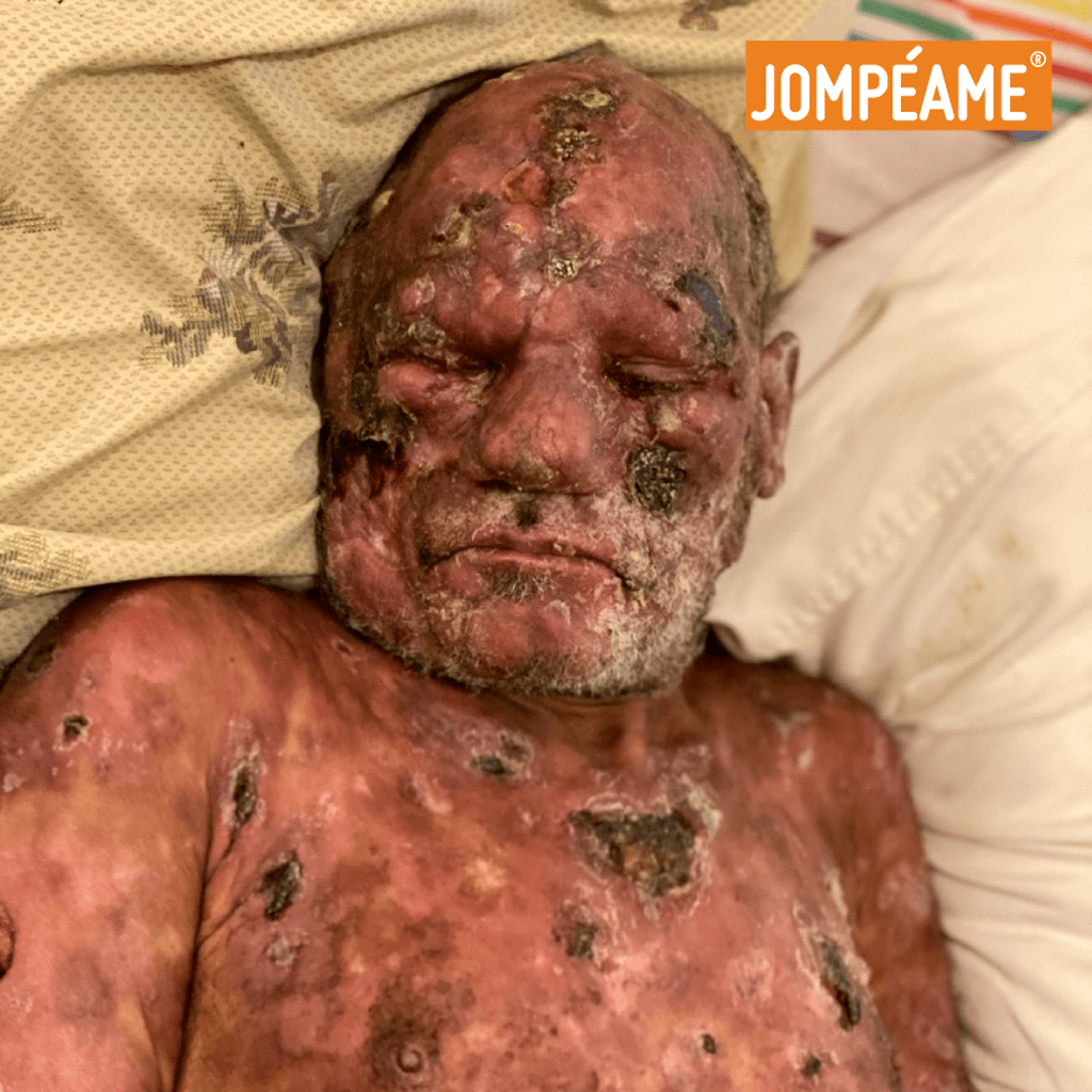 Francisco, sin miedo al c&aacute;ncer