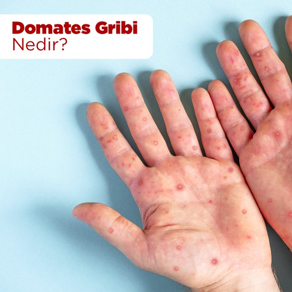 Domates Gribi
