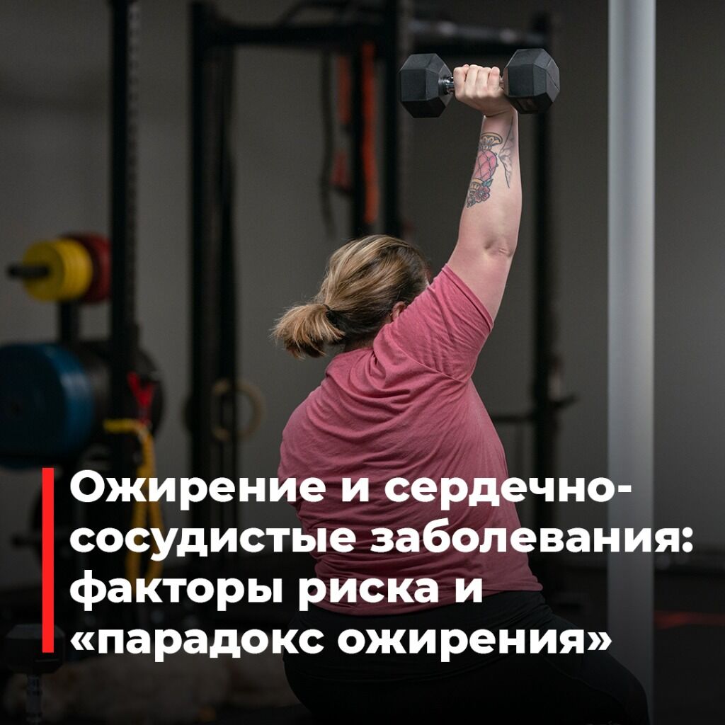 Ожирение