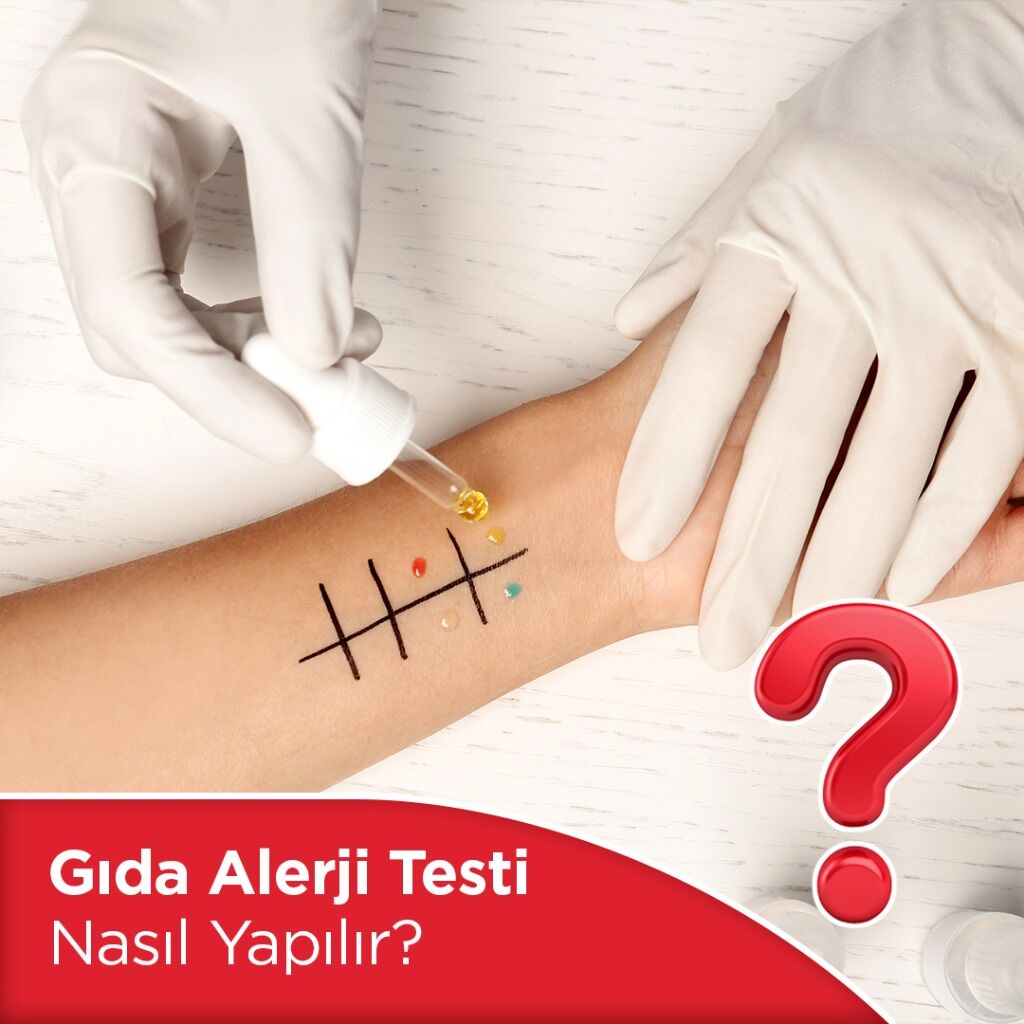 Gıda Alerji Testi